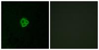 AT1 Polyclonal Antibody