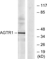 AT1 Polyclonal Antibody