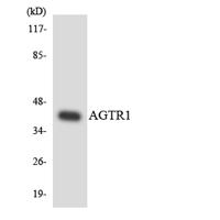 AT1 Polyclonal Antibody