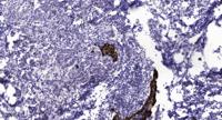 AT1 Polyclonal Antibody