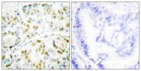 Ataxin-1 Polyclonal Antibody