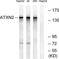 Ataxin-2 Polyclonal Antibody
