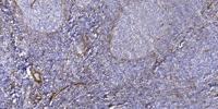 Ataxin-2 Polyclonal Antibody