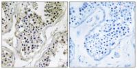 Ataxin-7L1 Polyclonal Antibody