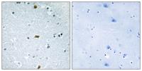 ATBF1 Polyclonal Antibody