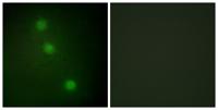 ATF-1 Polyclonal Antibody
