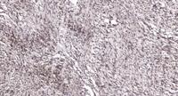 ATF-1 Polyclonal Antibody