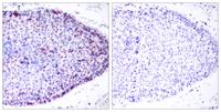 ATF-2 Polyclonal Antibody