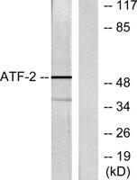 ATF-2 Polyclonal Antibody