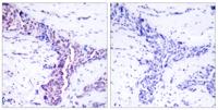 ATF-2 Polyclonal Antibody
