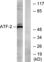 ATF-2 Polyclonal Antibody