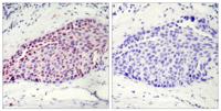 ATF-2 Polyclonal Antibody