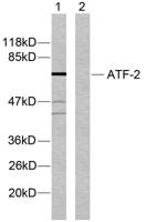 ATF-2 Polyclonal Antibody
