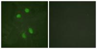 ATF-2 Polyclonal Antibody