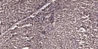 ATF-2 Polyclonal Antibody