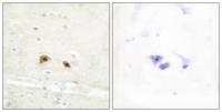 Egr-3 Polyclonal Antibody