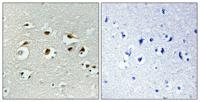 EID-1 Polyclonal Antibody