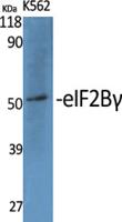 eIF2Bγ Polyclonal Antibody