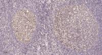 eIF2β Polyclonal Antibody