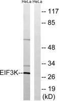 eIF3K Polyclonal Antibody