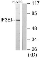eIF3L Polyclonal Antibody
