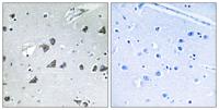 eIF3ε Polyclonal Antibody