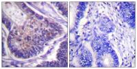 eIF4B Polyclonal Antibody