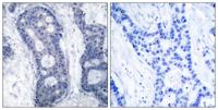 eIF4E Polyclonal Antibody