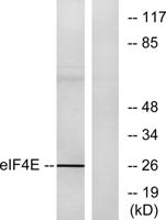 eIF4E Polyclonal Antibody