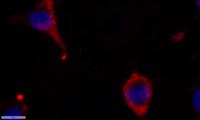 eIF5A2 Polyclonal Antibody
