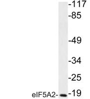 eIF5A2 Polyclonal Antibody