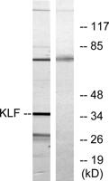 EKLF/CKLF/UKLF Polyclonal Antibody