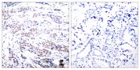 Elk-1 Polyclonal Antibody