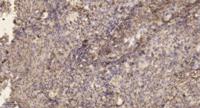 ELOVL2 Polyclonal Antibody