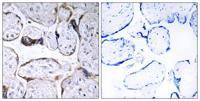 ELOVL3 Polyclonal Antibody
