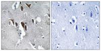 ELOVL5 Polyclonal Antibody