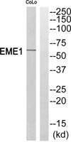 Eme1 Polyclonal Antibody