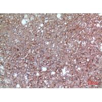 EMMPRIN Polyclonal Antibody