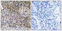 EMMPRIN Polyclonal Antibody