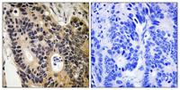 ENaC β Polyclonal Antibody