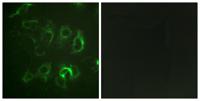 ENaC β Polyclonal Antibody
