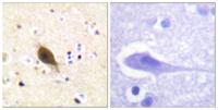 ENaC β Polyclonal Antibody