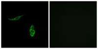 ENaCδ Polyclonal Antibody