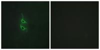 Endo180 Polyclonal Antibody