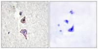 Endo180 Polyclonal Antibody