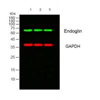 Endoglin Polyclonal Antibody