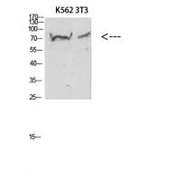 Endoglin Polyclonal Antibody