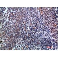 Endoglin Polyclonal Antibody