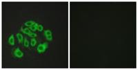 Endomucin Polyclonal Antibody