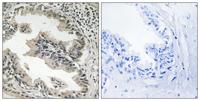 Endophilin B2 Polyclonal Antibody
